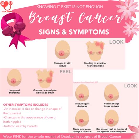 The whole breast may feel hot to the touch and may feel not only swollen but also rigid or firm. Breast Cancer : Symptoms and Signs. Lets bust the myth ...