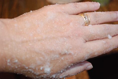home recipe for dry chapped hands you probably have everything you need already at home