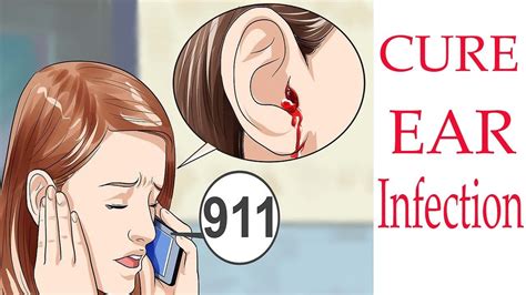 Fungal Ear Infection 7 Power Remedies To Treat A Fungal Ear Infection
