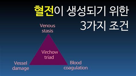 Thrombus 02 혈전이 생성되기 위한 3가지 조건 Virchows Triad Youtube