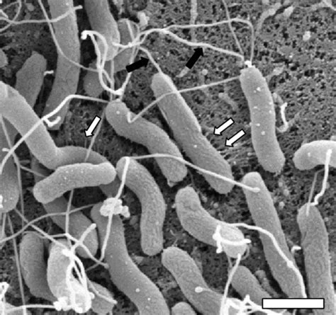 H Pylori Bacteria Infection Symptoms Diagnosis And Treatment