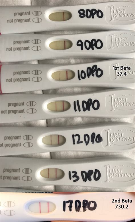 Positive Pregnancy Test 8Dpo - Bfn On Frer At 8dpo : A positive result