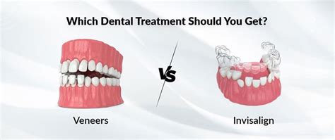 Veneers Vs Invisalign Which Dental Treatment Should You Get La Dental Clinic