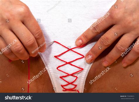 Hymenoplasty Restores Membrane Presexual State Hymenorrhaphy Foto Stok Shutterstock