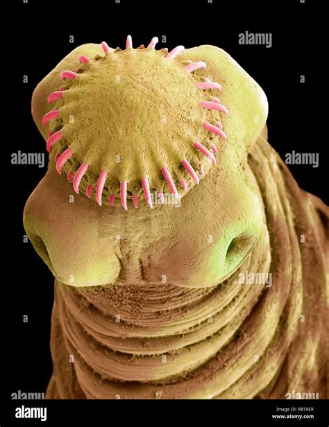 Tapeworm Under A Microscope
