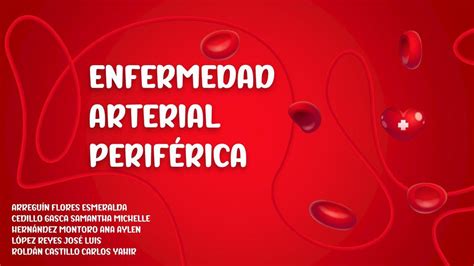 Enfermedad Arterial Periférica Samantha Cedillo Udocz