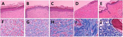 Representative Images Of Hande A E And Massons Trichrome Staining