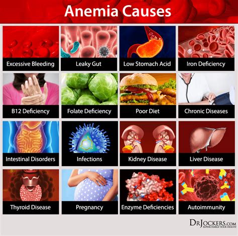 13 Ways to Heal Anemia Naturally - DrJockers.com