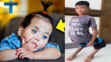 Top 10 Unusual And Amazing Kids Around The World You Wont Believe