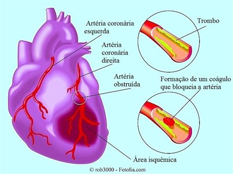 .vacinacao, kevin de bruyne, eder portugal, alex caruso, vacina covid, tony carreira, enfarte do miocárdio, sara carreira, tony carreira enfarte, tony, tony carreira internado, enfarte. infarto do miocárdio agudo, sintomas e tratamento