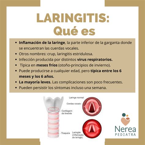 Top 107 Imagenes De La Laringitis Destinomexicomx
