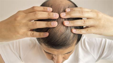 Hair Loss Treatment Dermatologists Report Incredible Results For