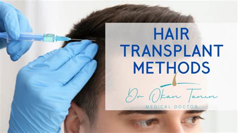 Hair Transplant Methods Dr Okan Tanın