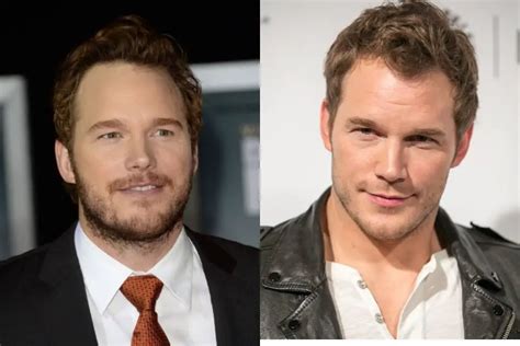 Chris Pratt Plastic Surgery Before And After Celebrity Sizes