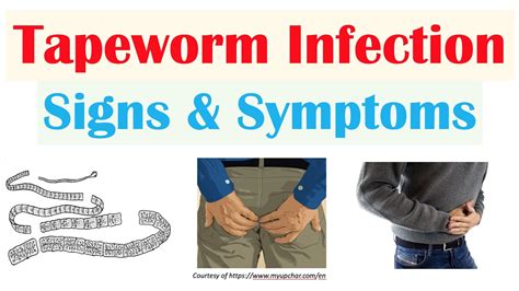 Tapeworm Infection Signs And Symptoms Nutrient Deficiencies And Complications Youtube