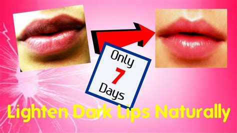 How To Lighten Dark Lips Naturally At Home Fast Youtube