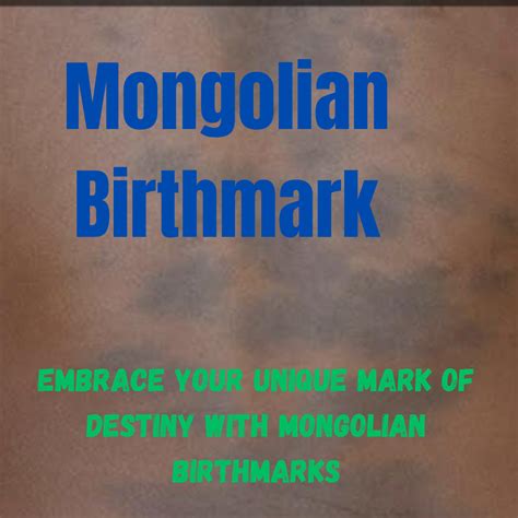 5 Astonishing Myths And Misconceptions About Mongolian Birthmarks That