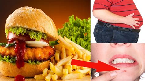 Fast Food Bad Health Effects What Happens To Your Body When You Eat Too Much Fast Food Youtube