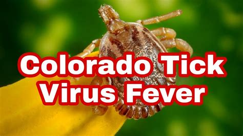 Colorado Tick Fever Causes Symptoms Diagnosis Treatment And Prevention Youtube