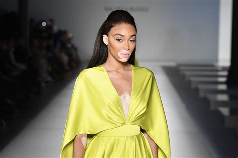 Winnie Harlow Net Worth 2024 What Is The Model Worth