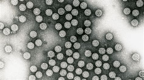 Close To Half Of American Adults Infected With Hpv Survey Finds The New York Times