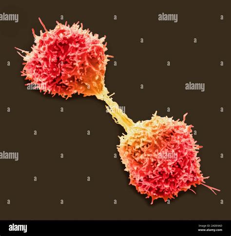 Lymphoma Cancer Cell Coloured Scanning Electron Micrograph Sem Of