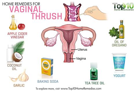 Home Remedies For Vaginal Thrush Top 10 Home Remedies