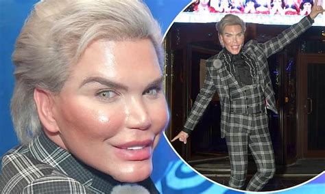 Rodrigo Alves EXCLUSIVE Human Ken Doll Celebrates Latest Face Lift