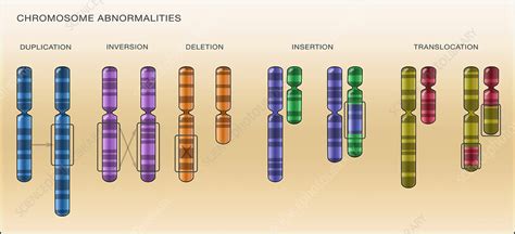 Chromosome Abnormalities Illustration Stock Image C0306636