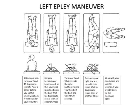 Epley Maneuver Pdf 3 Ways To Perform The Epley Maneuver Wikihow