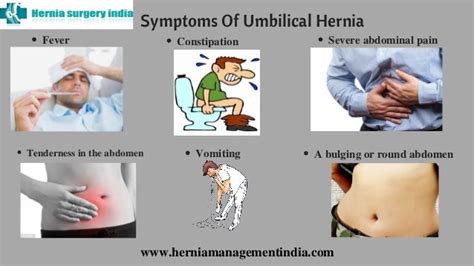 Umbilical Hernia Repair Surgery In Chennai Hernia Treatment For Fem