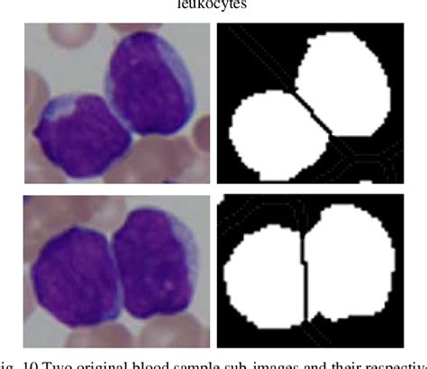 Leukocytes Microscope Images Micropedia