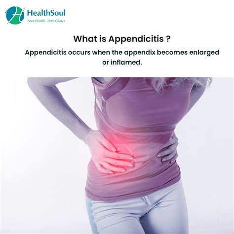 Appendicitis Common Cause Of Abdominal Pain In Young People