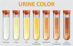 Dehydration Urine Color Chart Infographic Health Nutrition Chart 