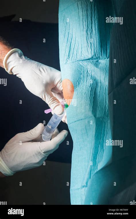 Anaesthtist Anaesthetic Injection In Knee For Surgery Hospital Operation Medical Procedure In