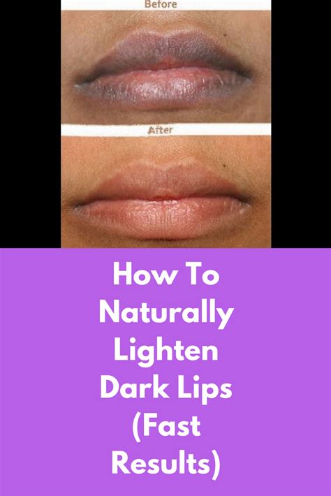 How To Naturally Lighten Dark Lips Fast Results First You Will Need A