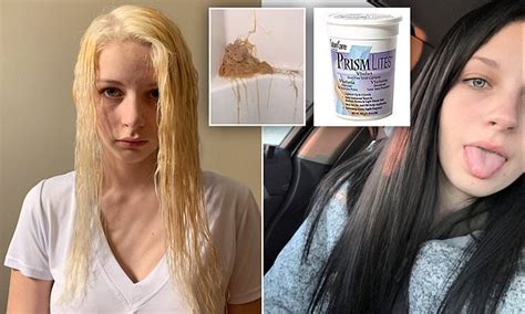 Teen Who Tried To Bleach Her Long Brown Hair Blonde Is Horrified When The Chemicals Melted Her