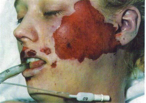 Private Eye Crimes: Paul Bernardo & Karla Homolka: The ...
