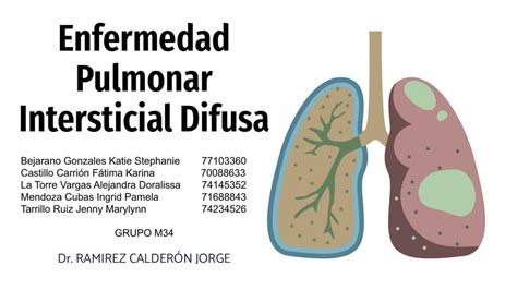 Enfermedad Pulmonar Intersticial Difusa Jenny Maryllynn Tarrillo Ruiz Udocz