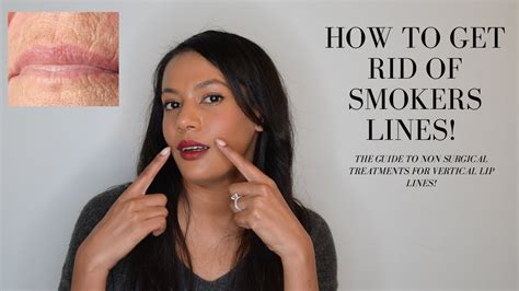 How To Get Rid Of Smoker S Lines Lip Wrinkles And Vertical Lip Lines