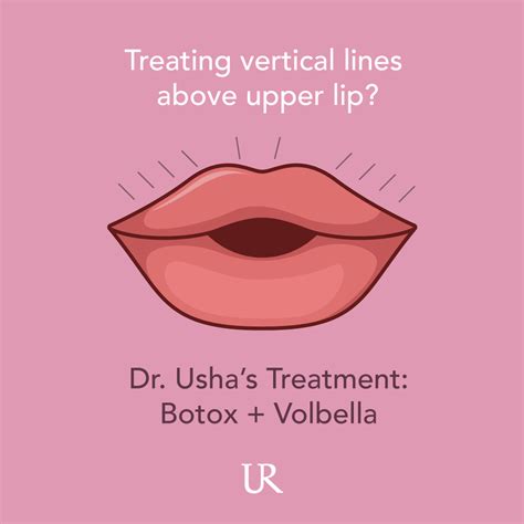 What Is Most Effective For Treating Vertical Lines Above The Upper Lip