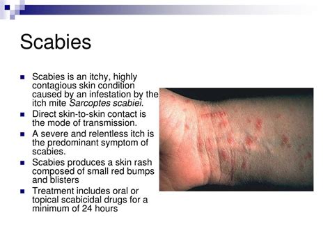 Ppt Contagious Skin Conditions Powerpoint Presentation Free Download