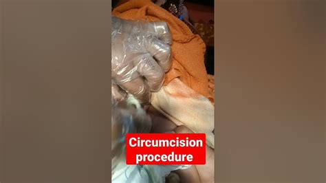 Circumcision Procedure Shorts Health Youtube