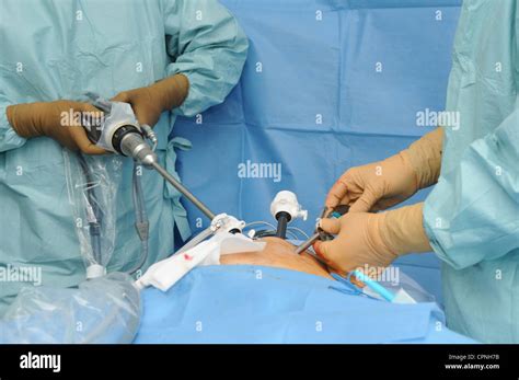 La Chirurgie De La Prostate Photo Stock Alamy