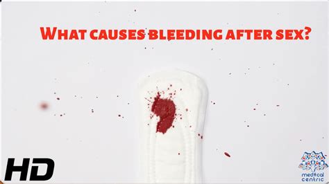 What Causes Bleeding After Sex Youtube