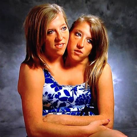 A História De Abby E Brittany Hensel As Famosas Gêmeas Conjugadas