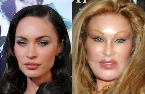 New Fashion Arrivals Us Top 7 Female Celebrities Plastic Surgery Disasters