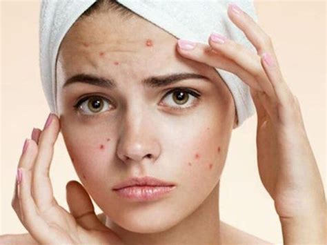 10 Best Home Remedies For Dark Spots On Your Face Get Clear Skin