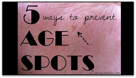 5 Ways To Prevent Age Spots