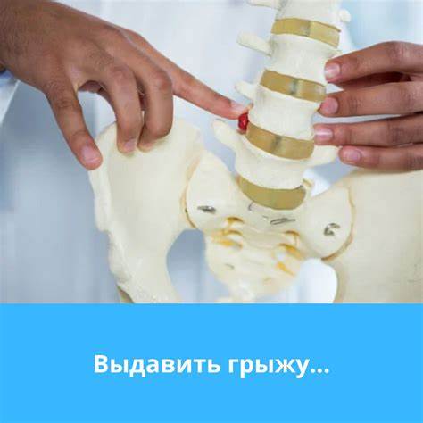 Диета и лечение грыжи пищевода Грыжа межпозвоночного диска: симптомы Грыжа межпозвоночного диска: симптомы Диета и лечение грыжи пищевода